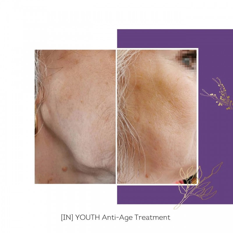 FLOREVE (IN) YOUTH – jūrinio kolageno maisto papildas su vitaminu C, vitaminu E, cinku ir augaliniais ekstraktais